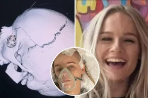 Shocking scans show Angel Lynn’s double skull fracture after falling out of van following kidnap by ex-boyfriend