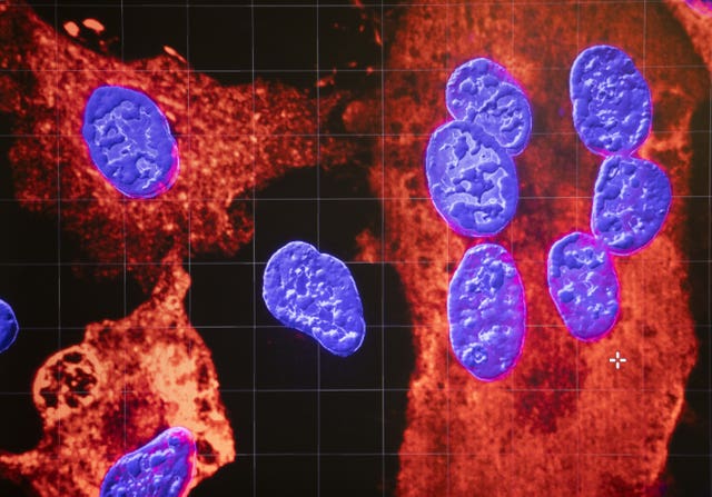 2-58748103 Infected cell nuclei