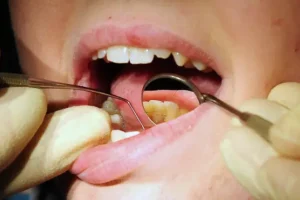 Bupa Dental Care to cut 85 practices in a move affecting 1,200 staff