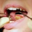 Bupa Dental Care to cut 85 practices