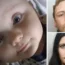 Finley suffered more than 100 injuries at the hands of his parents