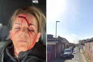 Female police officer suffers horrific gash to face after being rammed by suspected drug dealer