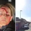 PC Woods suffered a serious injury