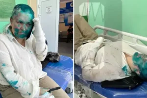 Female Russian journalist attacked by armed thugs, who cover her in green dye, shave her head and break her fingers