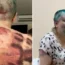 Elena Milashina received a brutal beating