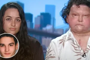 Man who underwent first face and double hand transplant has found love years after surgery