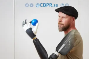 Above-the-elbow amputee ‘moves individual fingers in bionic limb in world first’