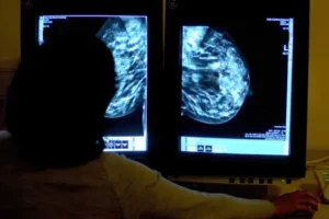 Adoption of AI in the NHS should be faster, experts say