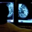 Clinician looking at a mammogram
