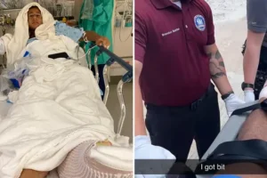 ‘I saw my foot in his mouth’: Student’s harrowing account of shark attack before rescue by friend