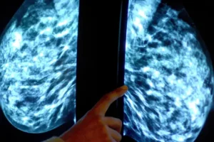 Health experts call on public to ‘trust’ artificial intelligence