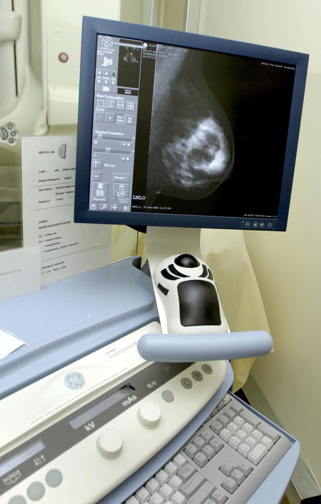 2-3649256 Breast cancer scan