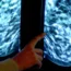 A radiologist examines mammogram images
