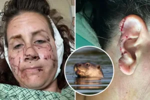 Woman left bloodied after ‘vicious and relentless’ otter attack saw the animal gouge her face and tear off part of her ear