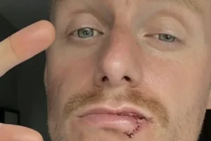 Couple making their way home from Black Pride fall victim to homophobic attack in south London