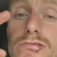 Michael Smith needed stitches in his lower lip after the attack