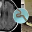 Medics discovered an 8cm worm in the woman's brain.