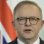 Anthony Albanese