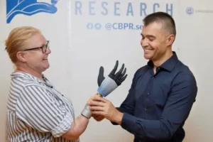 Bionic hand breakthrough could be ‘life-changing’ for amputees