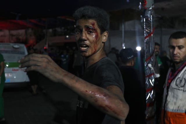 0c7fa8d54b7647df8f0d8b567b22db27 Injured man