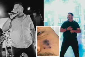 Brazilian singer, 28, dies after horror spider bite to face as stepdaughter hospitalised by same spider