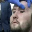 Eye transplant man Aaron James