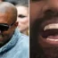 Ye appears to have taken out his teeth