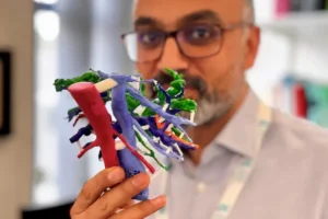 Surgeons develop 3D-printed liver models to plan complex cancer surgery