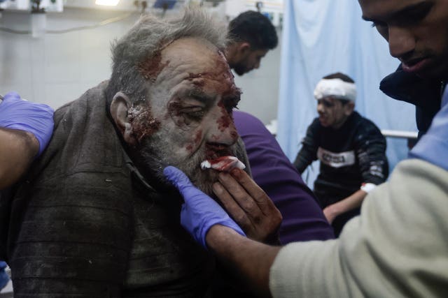 b733fd7bbfbe4991a2de7aa400153bbe Palestinians wounded in an Israeli bombardment receive treatment at the hospital in Khan Younis refugee camp, southern Gaza Strip