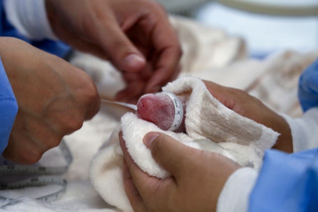 e302596bf498488dbaf4b86bda39bea0 The babies are measured